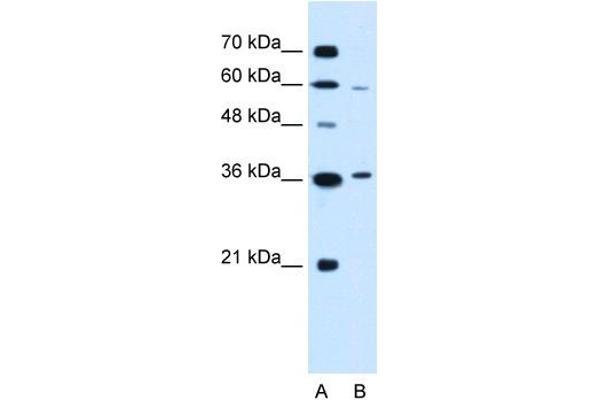 PARL anticorps  (N-Term)