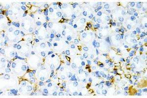 Immunohistochemistry of paraffin-embedded Mouse kidney using TAPBP Polyclonal Antibody at dilution of 1:200 (40x lens). (TAPBP 抗体)