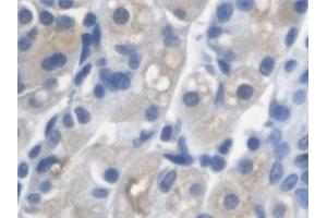 Immunohistochemistry (IHC) image for anti-Arylsulfatase A (ARSA) antibody (ABIN7441370)