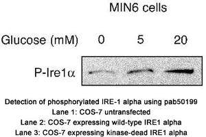 Image no. 2 for anti-Endoplasmic Reticulum To Nucleus Signaling 1 (ERN1) (pSer724) antibody (ABIN363508) (ERN1 抗体  (pSer724))