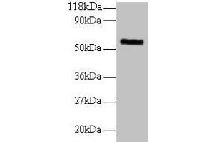 Western blot All lanes: MMP1 antibody at 2 μg/mL + 293T whole cell lysate Secondary Goat polyclonal to rabbit IgG at 1/10000 dilution Predicted band size: 55 kDa Observed band size: 55 kDa
