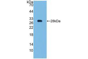 Western blot analysis of recombinant Human Bcl2. (Bcl-2 抗体  (AA 2-211))