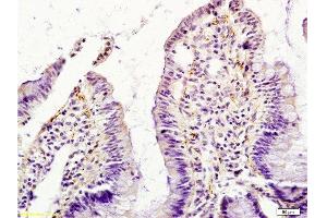 Formalin-fixed and paraffin embedded rat intestine tissue labeled with Anti-GM-CSF Polyclonal Antibody , Unconjugated at 1:200, followed by conjugation to the secondary antibody and DAB staining