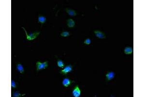 Immunofluorescent analysis of U251 cells using ABIN7168953 at dilution of 1:100 and Alexa Fluor 488-congugated AffiniPure Goat Anti-Rabbit IgG(H+L) (C7orf45 抗体  (AA 56-244))