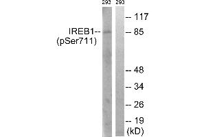 Immunohistochemistry analysis of paraffin-embedded human thyroid gland tissue using IREB1 (Phospho-Ser711) antibody. (Aconitase 1 抗体  (pSer711))