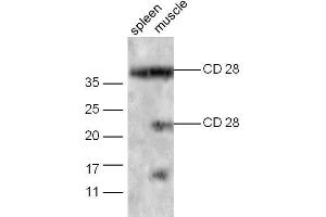 Mouse spleen probed with Rabbit Anti-CD28 Polyclonal Antibody Unconjugated  at 1:5000 for 90 min at 37˚C. (CD28 抗体  (AA 19-69))