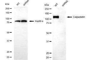 Western blotting analysis using calpastatin antibody (ABIN7797850). (Calpastatin 抗体)