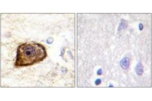 Immunohistochemistry analysis of paraffin-embedded human brain, using PDGFR beta (Phospho-Tyr1021) Antibody. (PDGFRB 抗体  (pTyr1021))