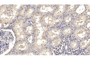 Detection of SMAD3 in Human Kidney Tissue using Monoclonal Antibody to SMAD family member 3 (SMAD3) (SMAD3 抗体  (AA 231-425))