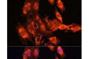 Immunofluorescence analysis of C6 cells using FSTL1 Polyclonal Antibody at dilution of 1:100. (FSTL1 抗体)