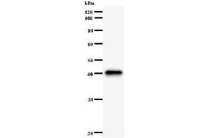 Western Blotting (WB) image for anti-Formin-Like 1 (FMNL1) antibody (ABIN931116)