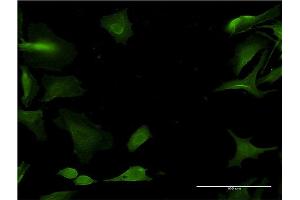 Immunofluorescence of monoclonal antibody to CYP1A2 on HeLa cell. (CYP1A2 抗体  (AA 211-310))