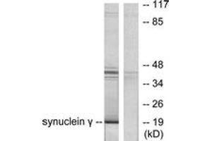 Western blot analysis of extracts from HT29 cells, using Synuclein gamma Antibody. (SNCG 抗体  (AA 78-127))