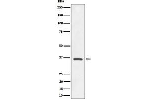 anti-Oxoglutarate (Alpha-Ketoglutarate) Receptor 1 (OXGR1) antibody
