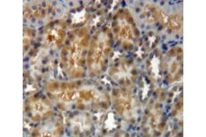 Used in DAB staining on fromalin fixed paraffin-embedded kidney tissue (Gelsolin 抗体  (AA 432-780))