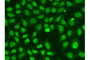 Immunofluorescence analysis of A549 cells using CHEK2 antibody. (CHEK2 抗体  (AA 1-220))