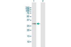 Western Blot analysis of NCR3 expression in transfected 293T cell line by NCR3 MaxPab polyclonal antibody.