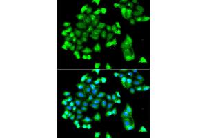 Immunofluorescence analysis of A549 cell using FBXO7 antibody. (FBXO7 抗体)