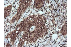 Image no. 6 for anti-Leucine Zipper and CTNNBIP1 Domain Containing (LZIC) antibody (ABIN1499239)