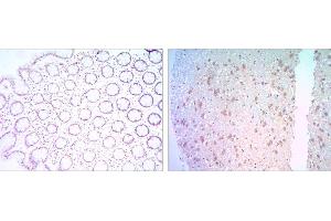 Immunohistochemical analysis of paraffin-embedded colon cancer tissues (left) and human brain tissues (right) using BCL-2 mouse mAb with DAB staining. (Bcl-2 抗体)