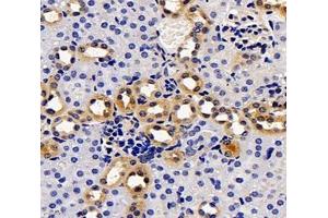 Immunohistochemistry analysis of paraffin-embedded mouse kidney using,PKD2L1 (ABIN7075125) at dilution of 1: 3400 (PKD2L1 抗体)