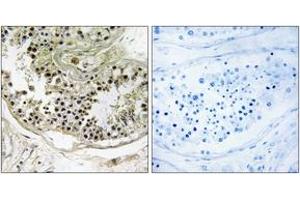Immunohistochemistry analysis of paraffin-embedded human testis tissue, using DYNLRB2 Antibody.