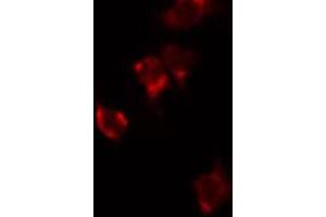 ABIN6272351 staining HuvEc by IF/ICC. (MRPL48 抗体  (Internal Region))