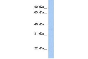 WB Suggested Anti-SULT1C2 Antibody Titration:  0. (SULT1C2 抗体  (C-Term))