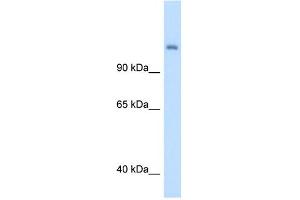 CPS1 antibody used at 5 ug/ml to detect target protein. (CPS1 抗体  (Middle Region))