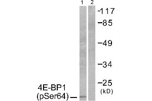 Western blot analysis of extracts from Jurkat cells, treated with Insulin (0. (eIF4EBP1 抗体  (pSer64))