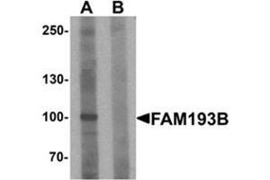 Western blot analysis of FAM193B in Jurkat cell lysate with FAM193B Antibody  at 1 ug/ml in (A) the absence and (B) the presence of blocking peptide. (FAM193B 抗体  (N-Term))
