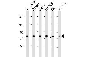 All lanes : Anti-GARS Antibody (C-term) at 1:2000 dilution Lane 1: NCI- whole cell lysate Lane 2: Ramos whole cell lysate Lane 3: Jurkat whole cell lysate Lane 4: HT-1080 whole cell lysate Lane 5: C6 whole cell lysate Lane 6: mouse brain lysate Lysates/proteins at 20 μg per lane. (GARS 抗体  (C-Term))