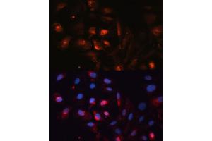 Immunofluorescence analysis of U2OS cells using  antibody (ABIN6133586, ABIN6137050, ABIN6137052 and ABIN6225252) at dilution of 1:100. (Aquaporin 5 抗体  (AA 150-250))