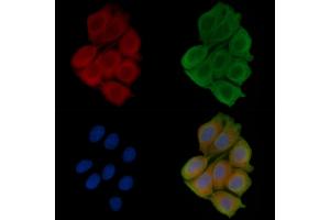 ABIN6256850 and ABIN6273556 staining Hela cells(45 min of heat-shock treatment) by IF/ICC.
