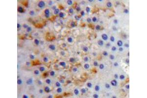 IHC-P analysis of liver tissue, with DAB staining. (IL17RC 抗体  (AA 257-477))