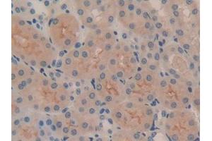 Detection of ITGaV in Mouse Kidney Tissue using Polyclonal Antibody to Integrin Alpha V (ITGaV) (CD51 抗体  (AA 71-322))