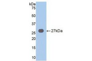 Detection of Recombinant VAV3, Human using Polyclonal Antibody to Vav 3 Oncogene (VAV3) (VAV3 抗体  (AA 183-380))