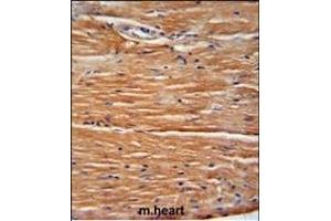 GIT1 Antibody (Center) (ABIN6243000 and ABIN6578993) immunohistochemistry analysis in formalin fixed and paraffin embedded mouse heart tissue followed by peroxidase conjugation of the secondary antibody and DAB staining. (GIT1 抗体  (AA 485-512))