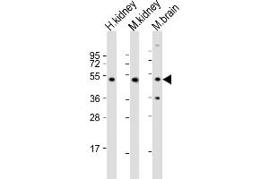 All lanes : Anti-NDUFV1 Antibody (N-term) at 1:2000 dilution Lane 1: human kidney lysate Lane 2: mouse kidney lysate Lane 3: mouse brain lysate Lysates/proteins at 20 μg per lane. (NDUFV1 抗体  (N-Term))