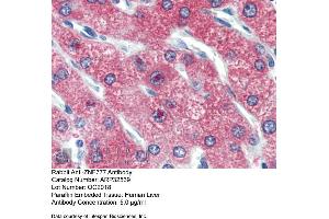 Immunohistochemistry with Human Liver cell lysate tissue at an antibody concentration of 5. (ZNF777 抗体  (Middle Region))