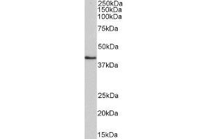ABIN4902659 (0. (HMBS 抗体)