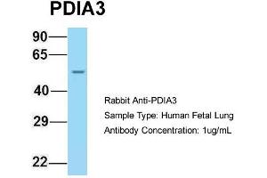 Host: Rabbit  Target Name: PDIA3  Sample Tissue: Human Fetal Lung  Antibody Dilution: 1. (PDIA3 抗体  (C-Term))