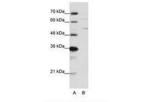 Image no. 2 for anti-Heterogeneous Nuclear Ribonucleoprotein K (HNRNPK) (N-Term) antibody (ABIN6736200) (HNRNPK 抗体  (N-Term))