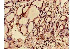 Immunohistochemistry of paraffin-embedded human thyroid tissue using ABIN7174723 at dilution of 1:100 (C12orf43 抗体  (AA 1-263))