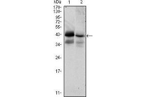 Western blot analysis using EPCAM mouse mAb against HTC116 (1) and T47D (2) cell lysate. (EpCAM 抗体)