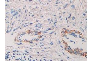 Used in DAB staining on fromalin fixed paraffin- embedded kidney tissue (NUCB2 抗体  (AA 25-104))