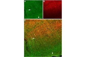 Expression of SSTR2 in mouse cortex - Immunohistochemical staining of frozen mouse cortex sections using Anti-Somatostatin Receptor Type 2 (extracellular) Antibody (ABIN7043765, ABIN7045268 and ABIN7045269), (1:100). (SSTR2 抗体  (Extracellular, N-Term))