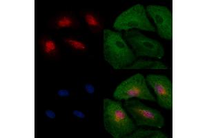 ABIN6263548 and ABIN6277572 staining  cells by IF/ICC. (NDC80 抗体  (C-Term))