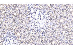 Detection of CNR1 in Rat Kidney Tissue using Polyclonal Antibody to Cannabinoid Receptor 1, Brain (CNR1) (CNR1 抗体  (AA 1-117))