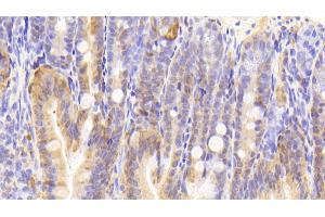 Detection of GAL2 in Mouse Colon Tissue using Polyclonal Antibody to Galectin 2 (GAL2) (Gallinacin-2 (GAL2) (AA 1-130) 抗体)
